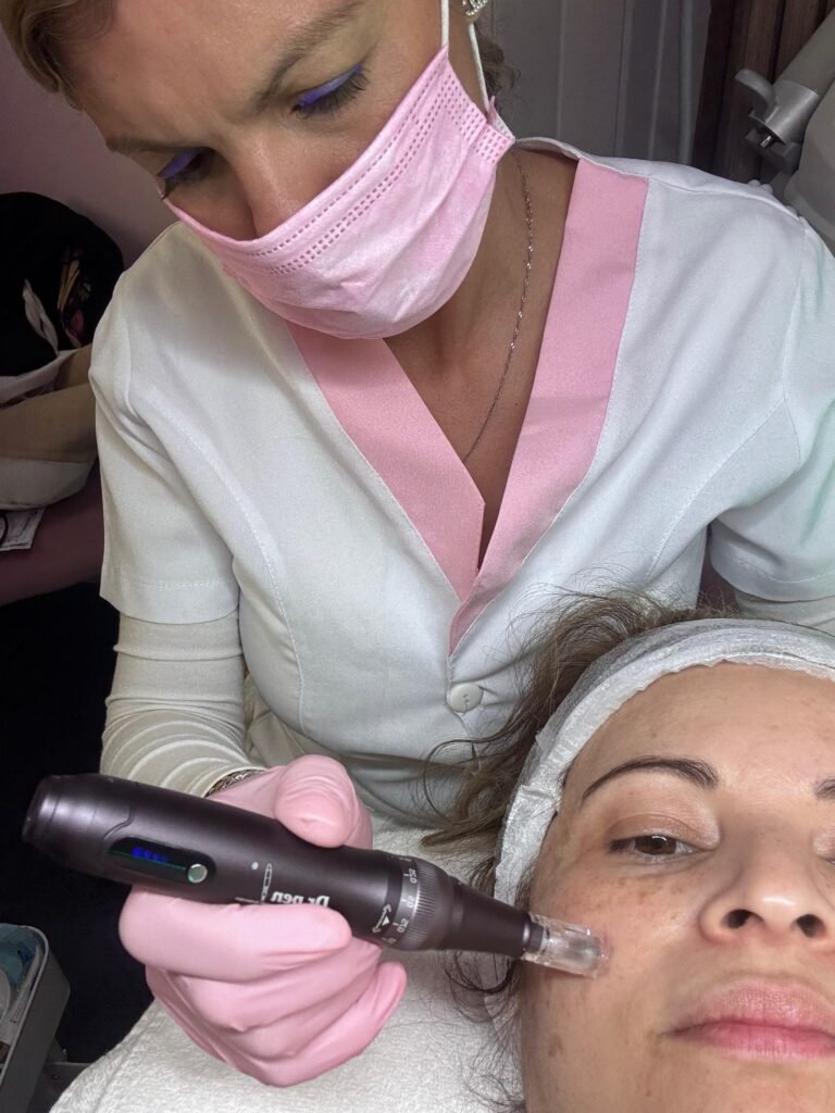 Aplicación de peeling facial químico paso a paso Aplicación de peeling facial químico en Benalmádena, paso a paso
