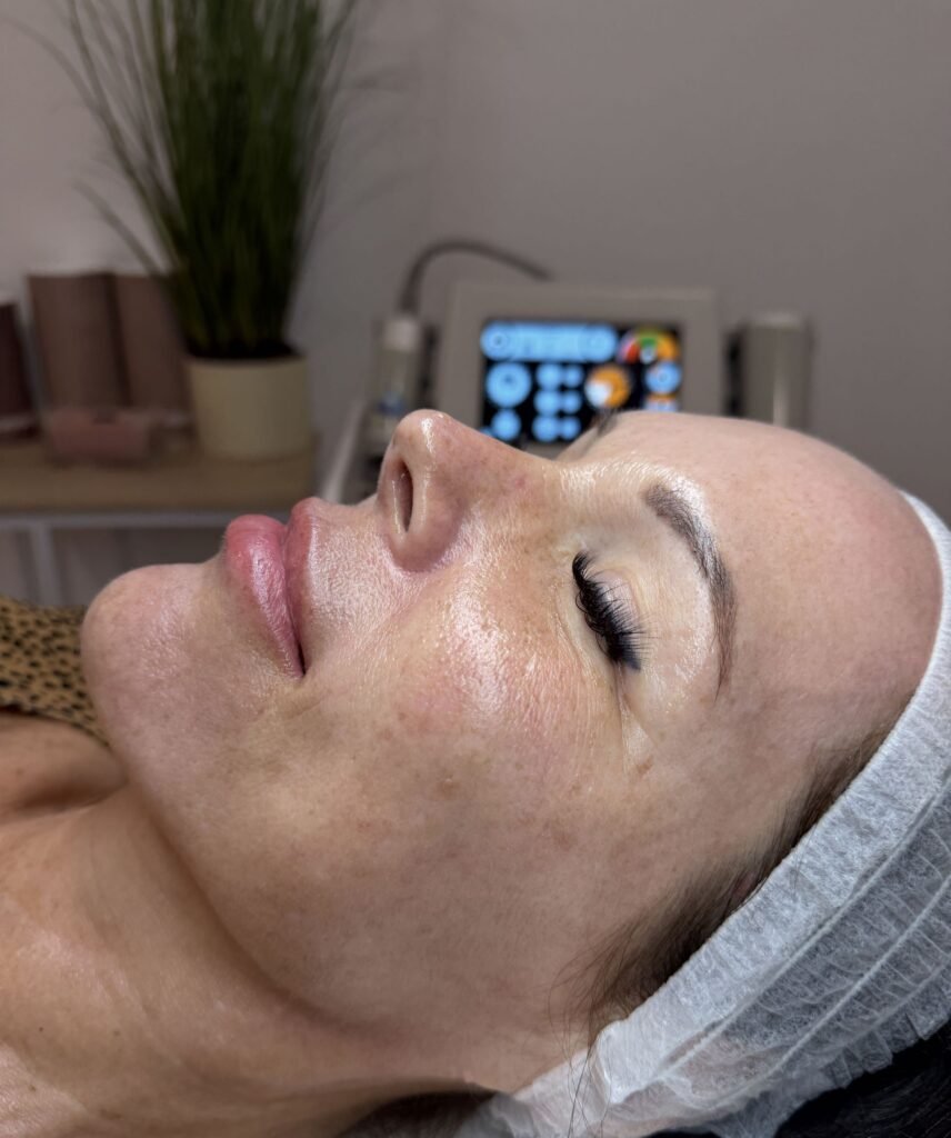 limpieza facial profunda