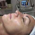 limpieza facial profunda mujer