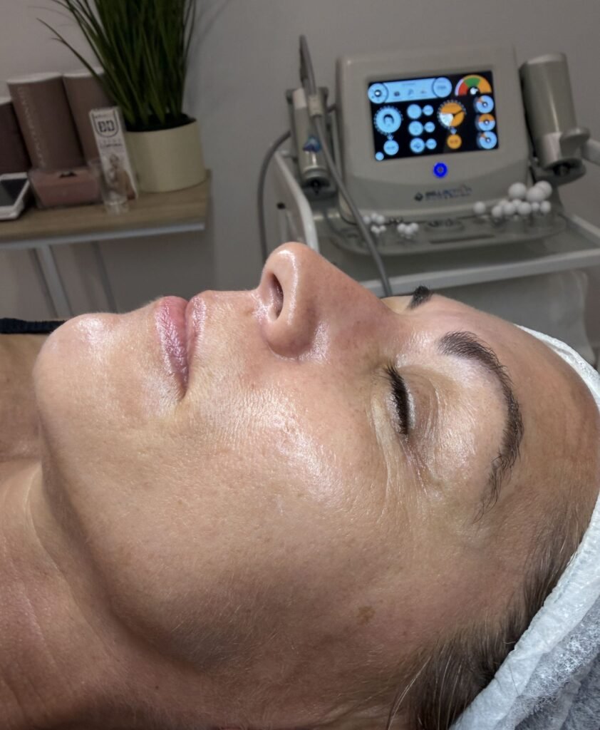 limpieza facial profunda mujer