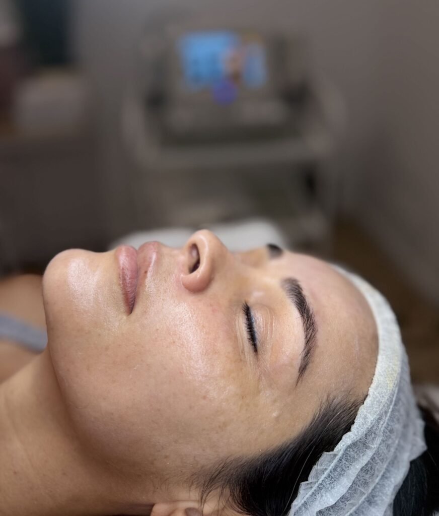 limpieza facial profunda en Arrollo de la miel